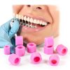 ZJchao Silicone Code Rings Pack of 100 Small Dental Instrument Bands-1